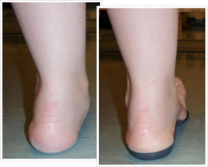 askel-lintassa-askel-oikaistu